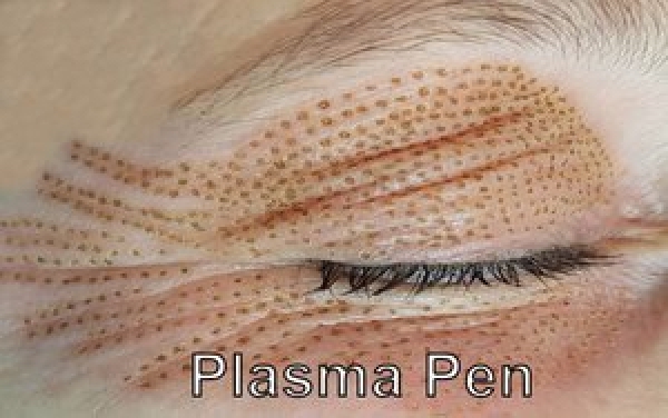 Schooling Plasma Pen